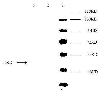 Indirect ELISA kit for detecting porcine transfusion transmitted virus 2 (TTV2) antibody