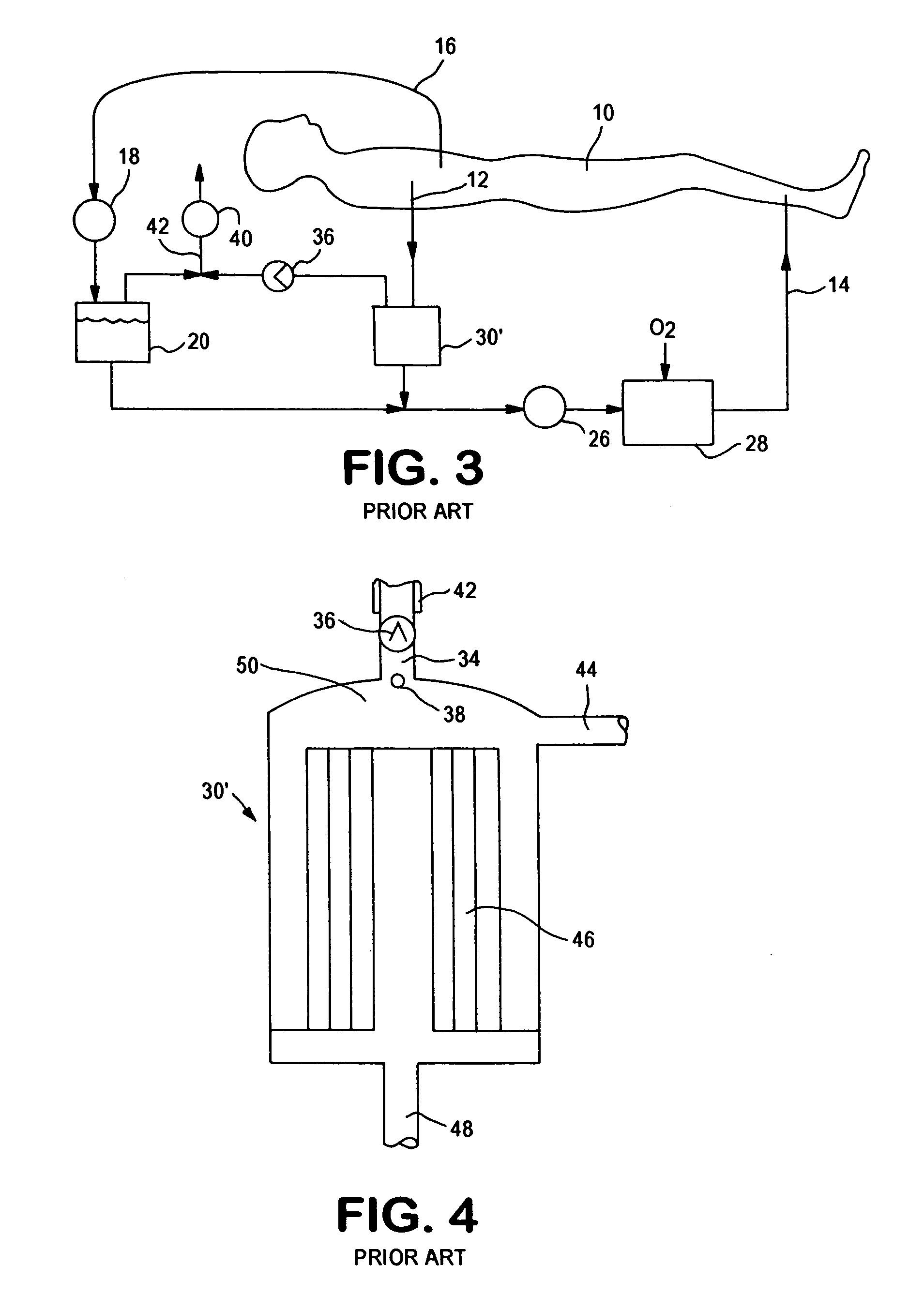 Active air removal system operating modes of an extracorporeal blood circuit