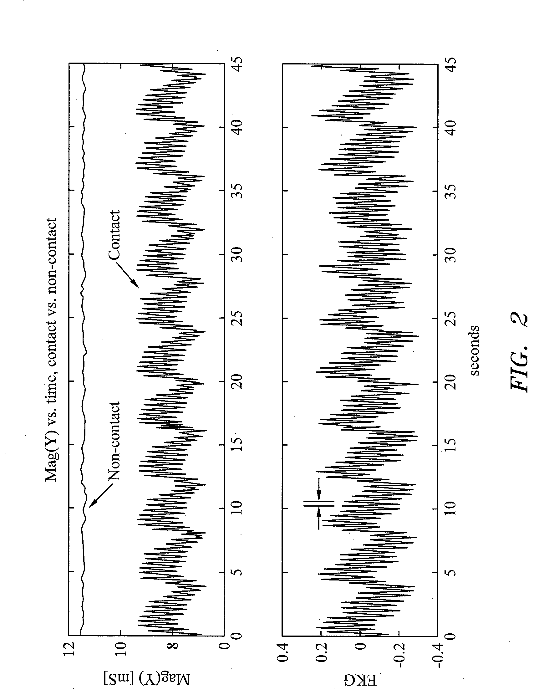 System and method for determining electrode-tissue contact based on amplitude modulation of sensed signal