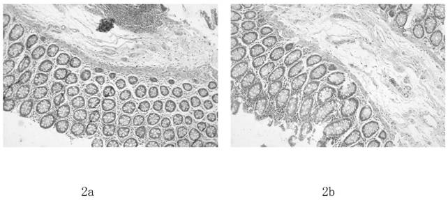 Novel pathological sealing sheet material