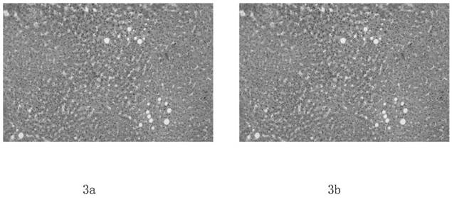 Novel pathological sealing sheet material