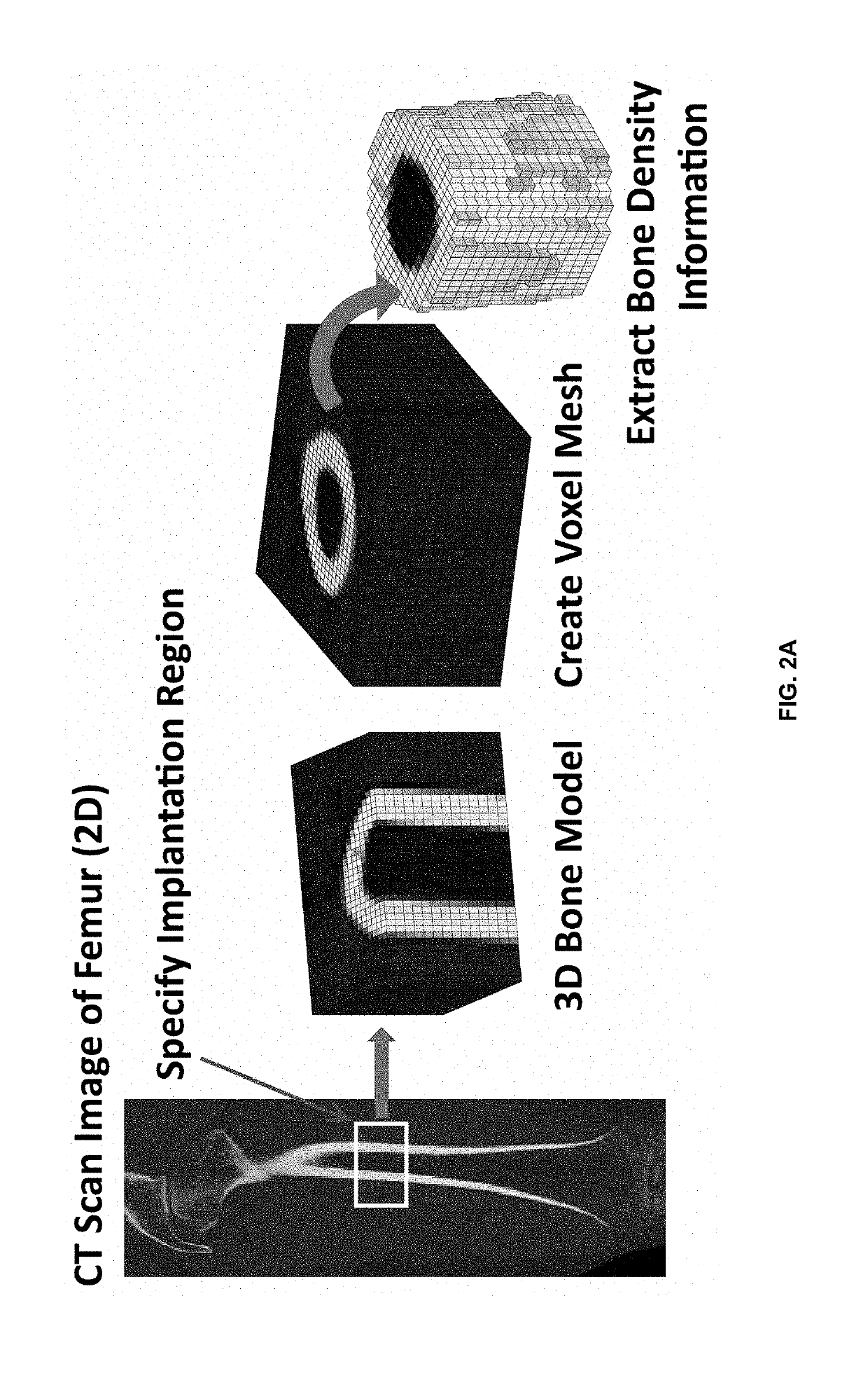 Method for adjusting mechanical properties of implant and patient specific surgical implants