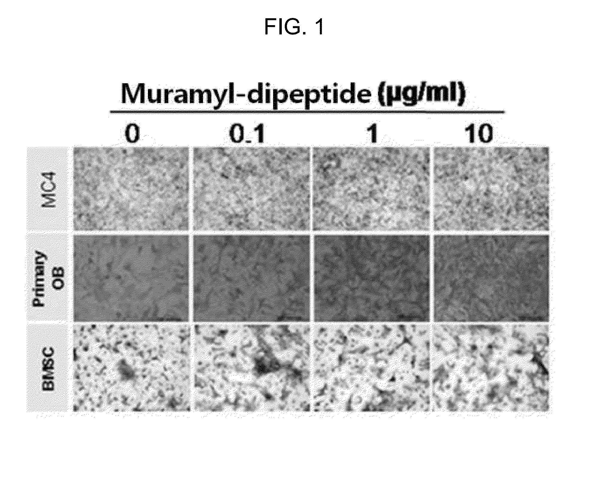 Bone loss preventing and bone regeneration or bone formation promoting pharmaceutical composition comprising muramyl dipeptide