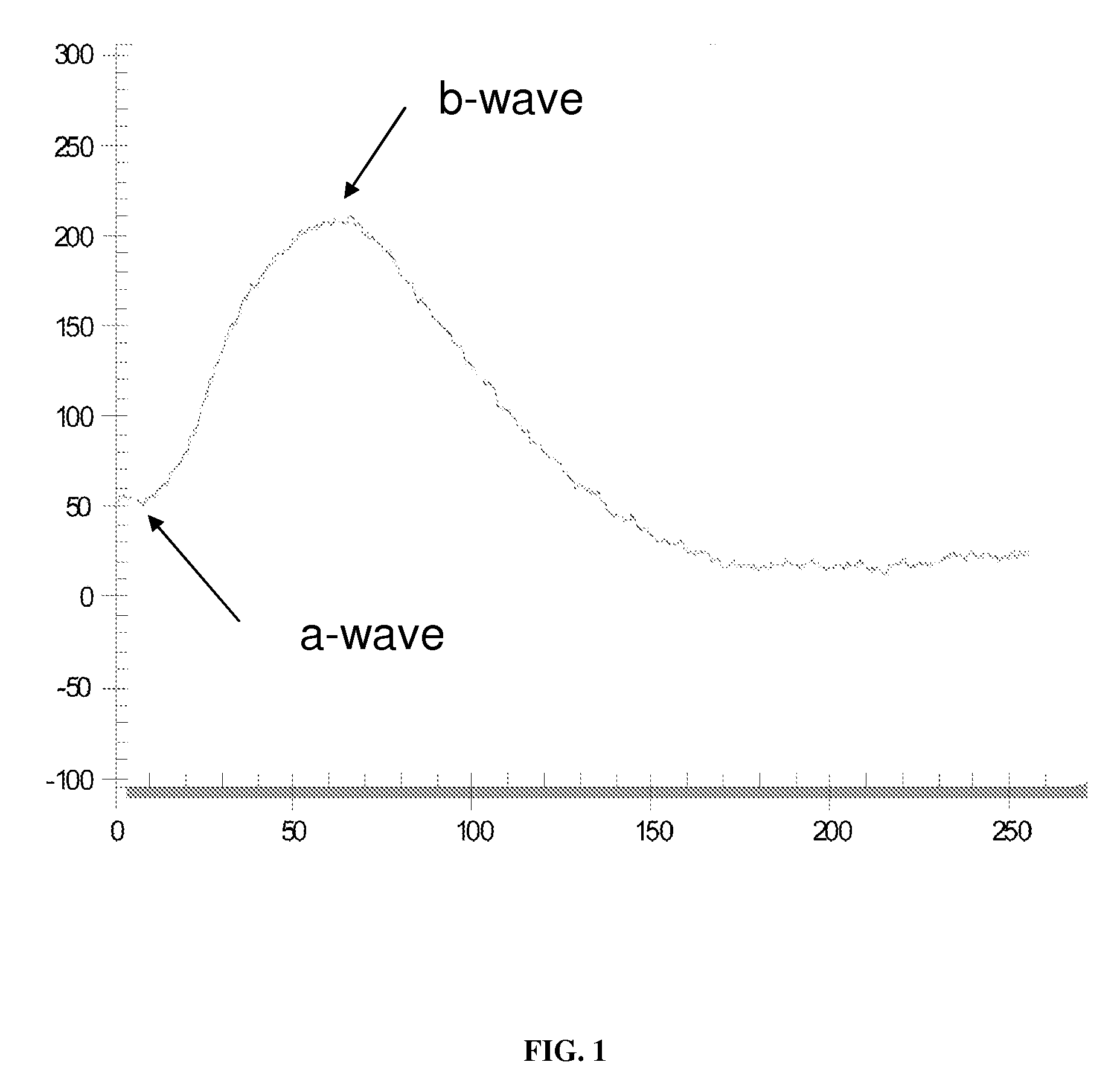 Method to Detect Transmissible Spongiform Encephalopathies Via Electroretinogram