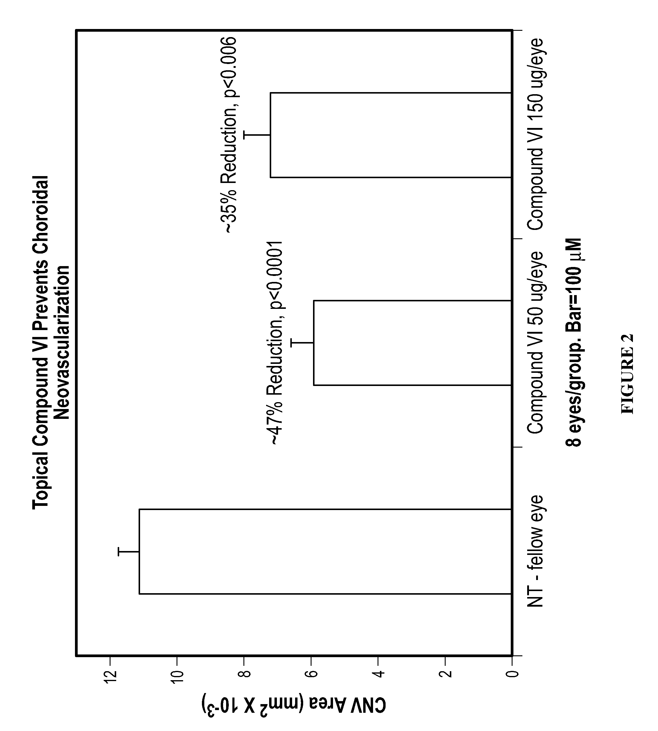 Methods and compositions for the treatment of ocular disorders