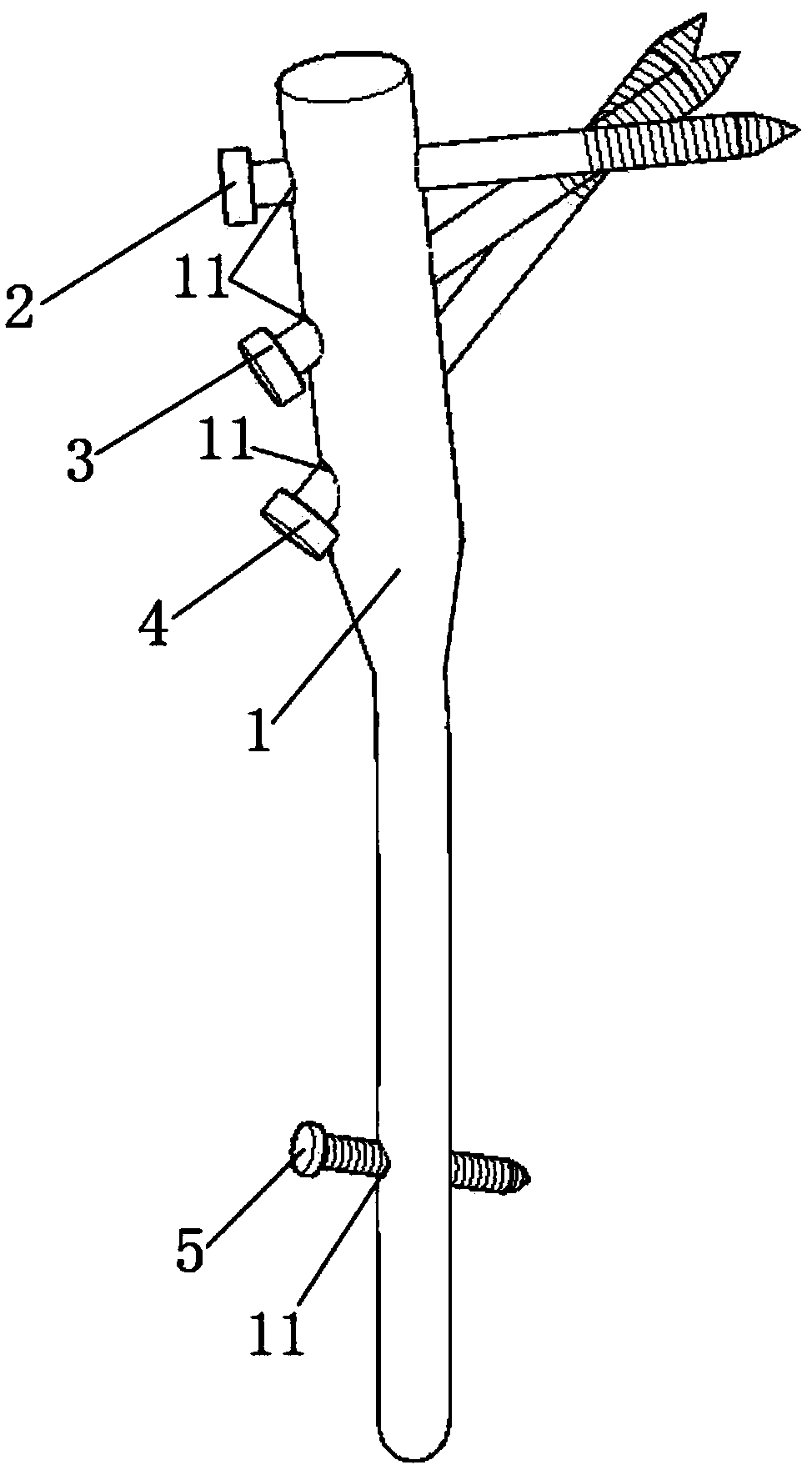 Modified proximal femoral nail