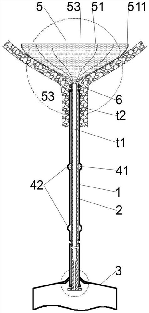 Indwelling catheter