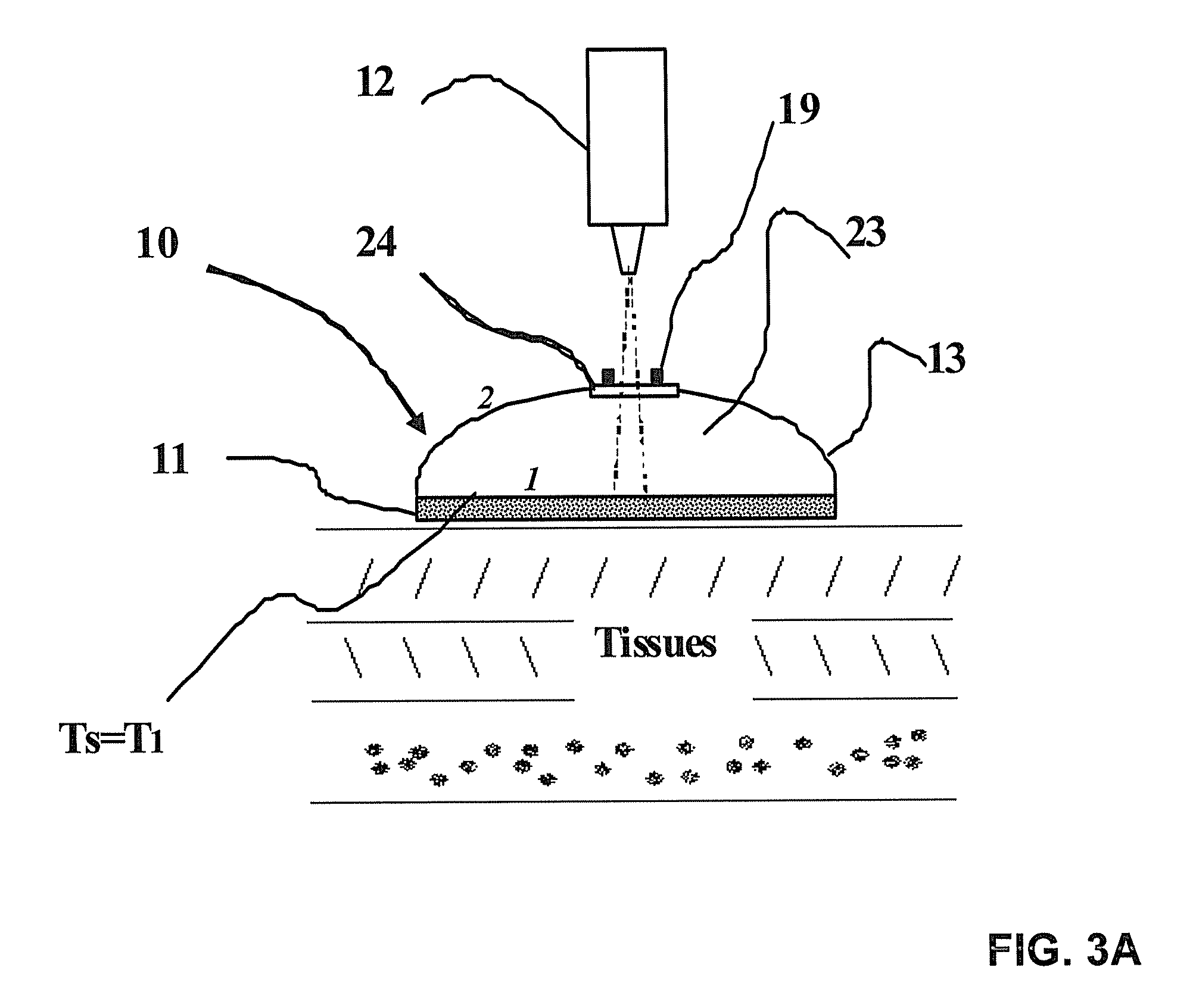 Temperature measurement device