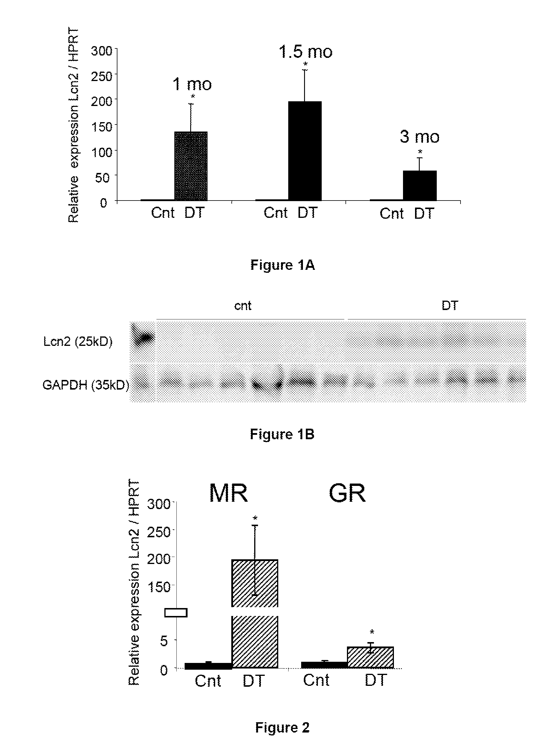 Biomarkers of Mineralocorticoid Receptor Activation