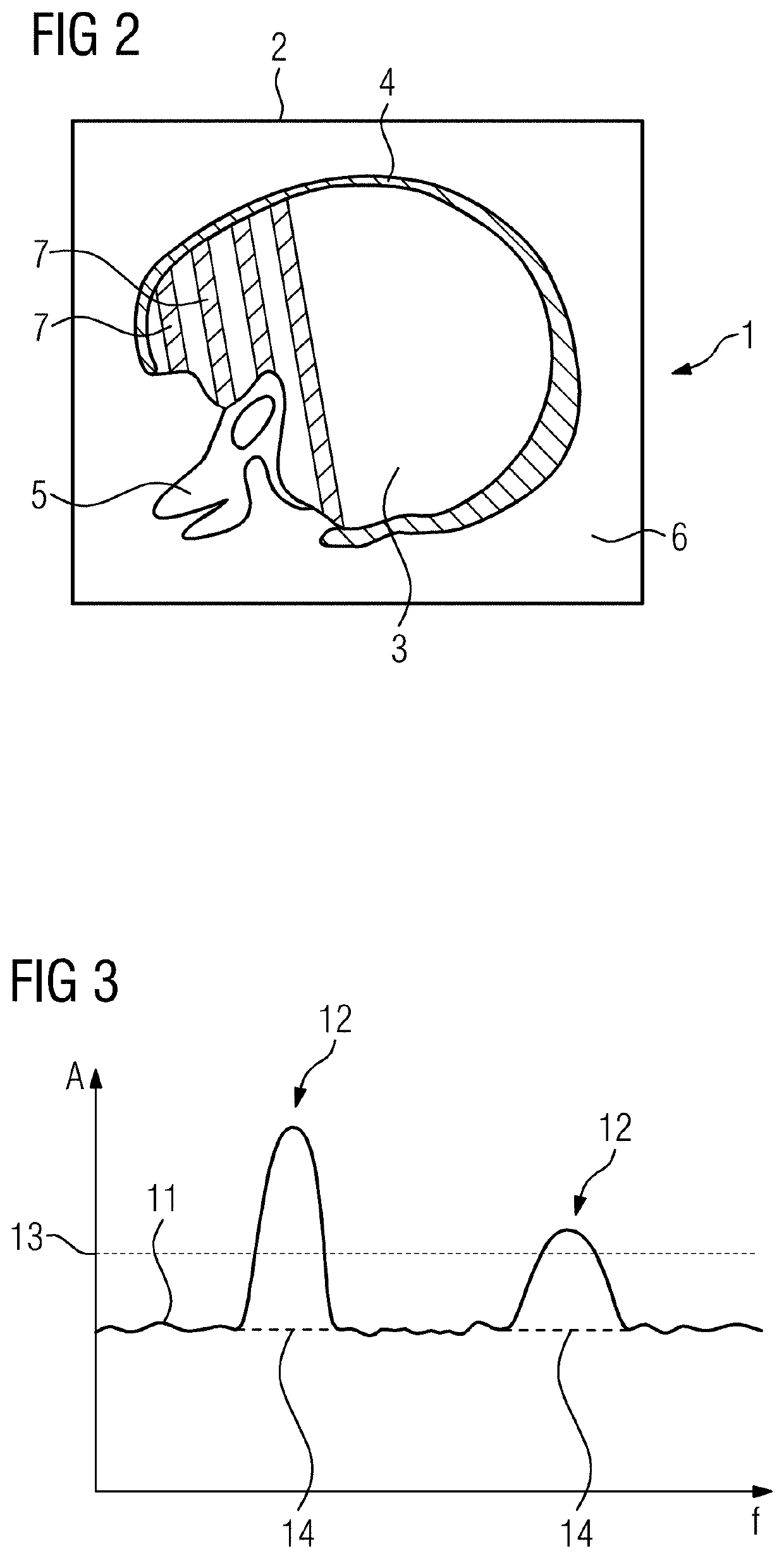 Method for artifact reduction in a medical image data set, x-ray device, computer program and electronically readable data carrier