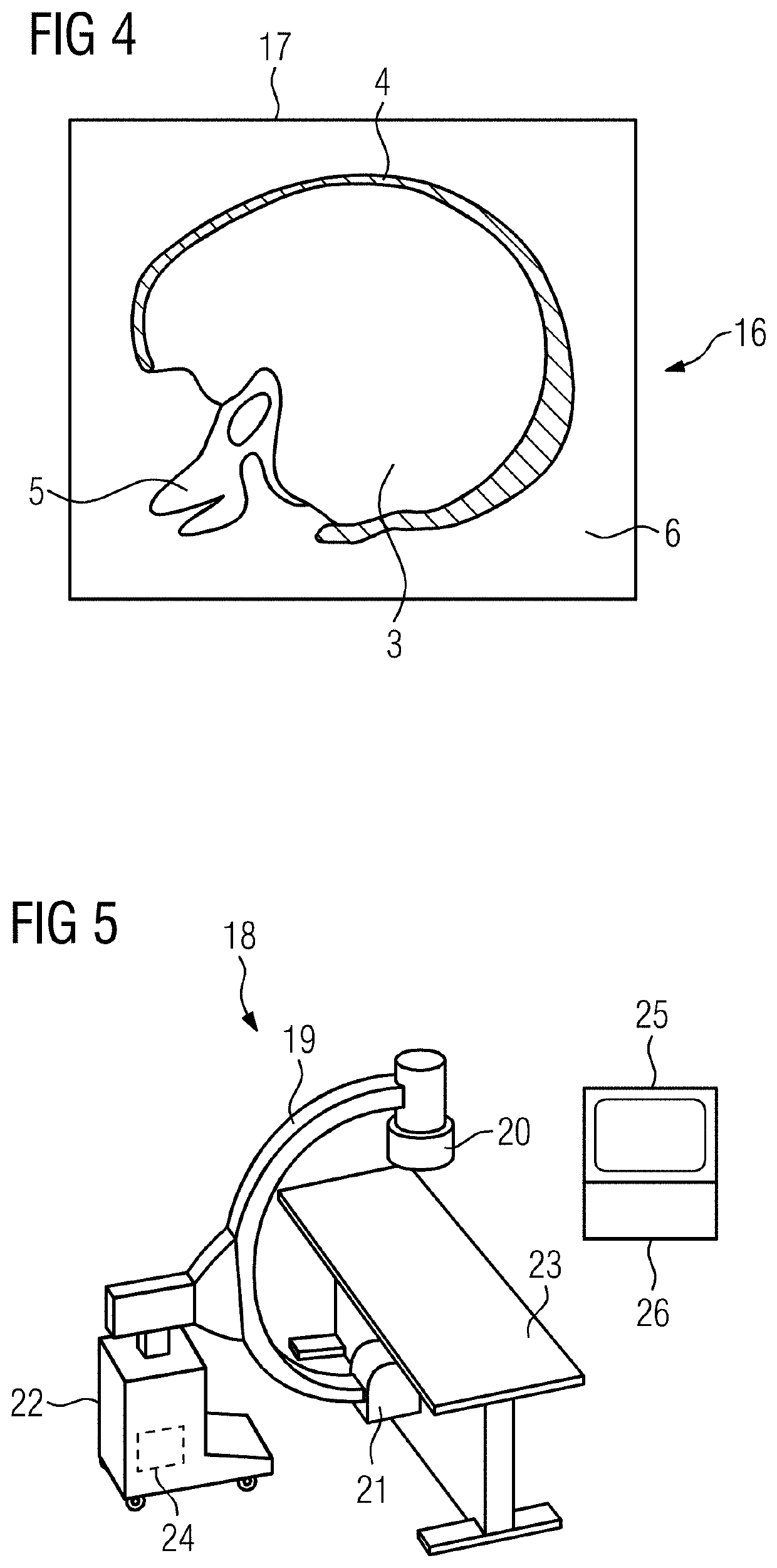 Method for artifact reduction in a medical image data set, x-ray device, computer program and electronically readable data carrier