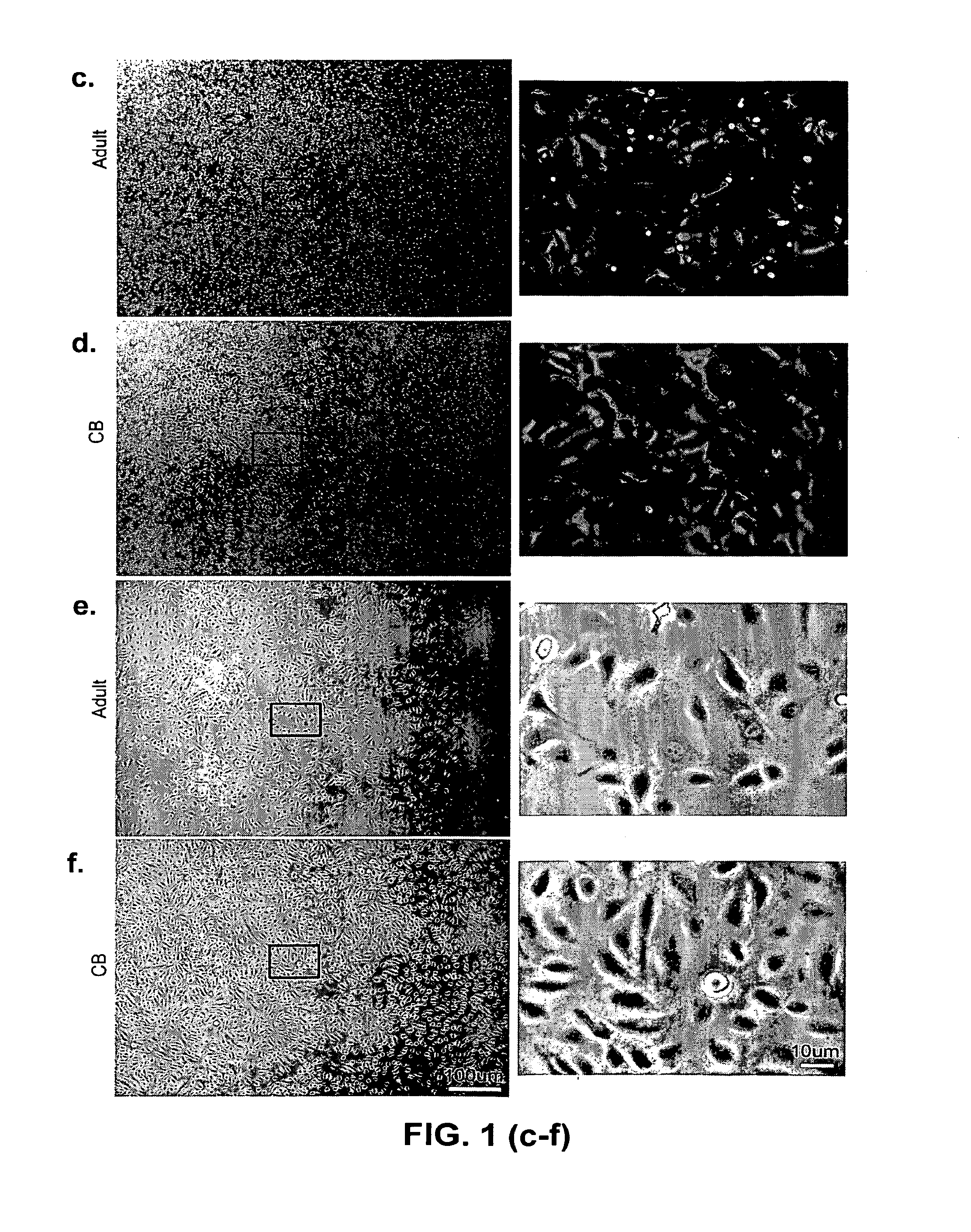 Isolation, expansion and use of clonogenic endothelial progenitor cells