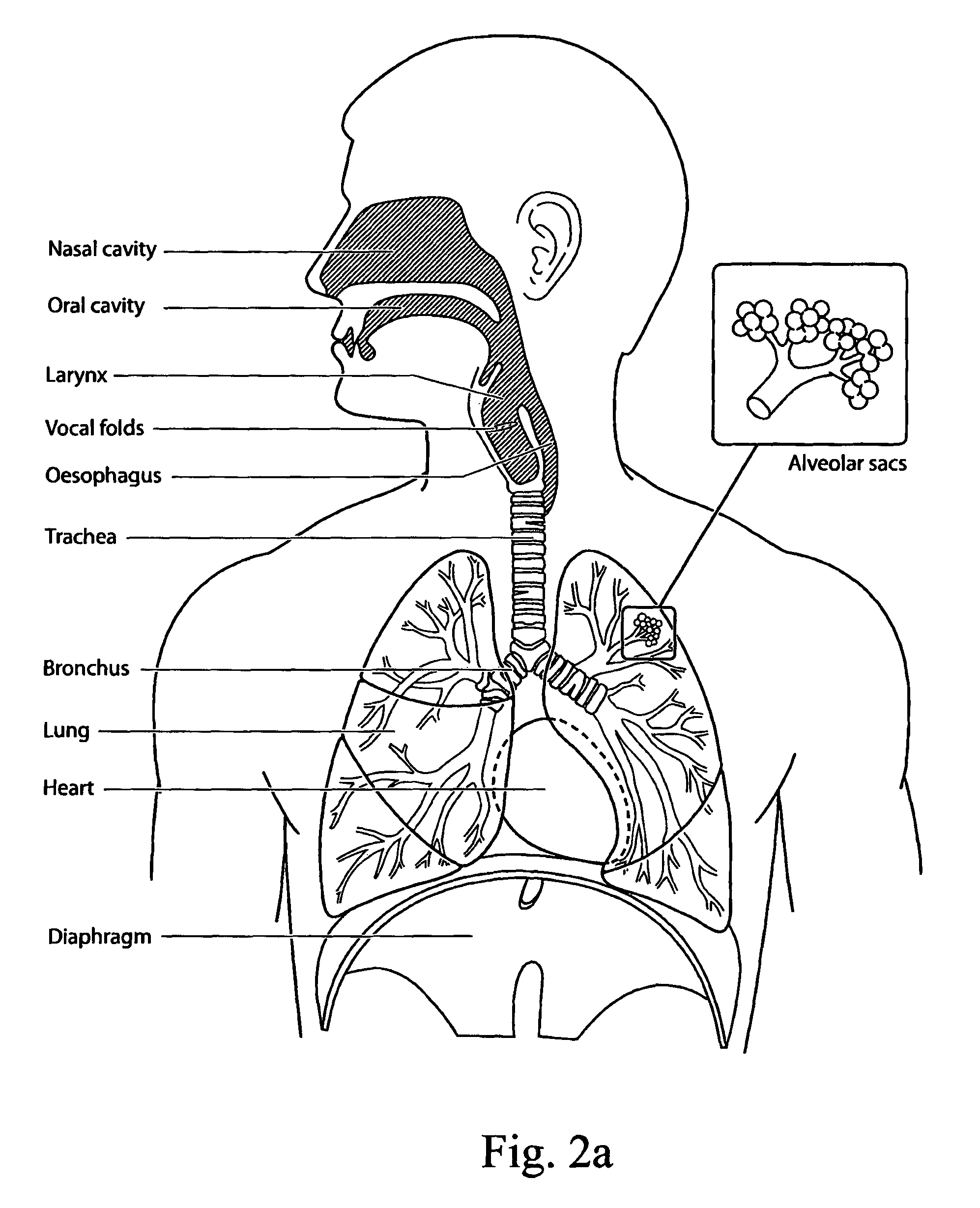 Patient interface