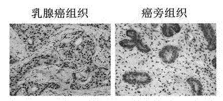 Recombinant lentiviral vector containing ubiquitin-specific protease gene USP39-shRNA (short hairpin ribonucleic acid) and application thereof