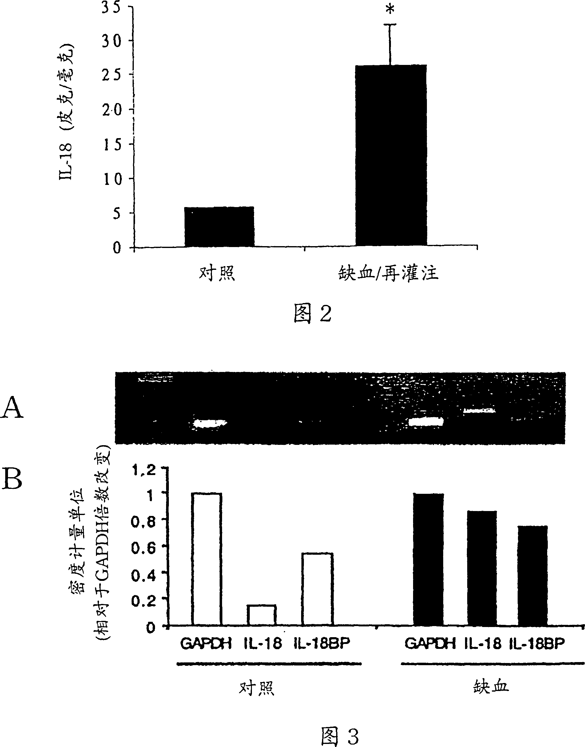 Use of Il-18 inhibitors for treatment and/or prevention of heart disease