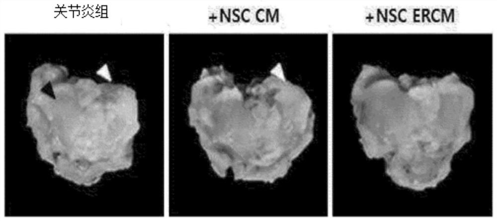 Composition comprising stem cell-derived exosome containing culture as effective ingredient for preventing or treating arthritis