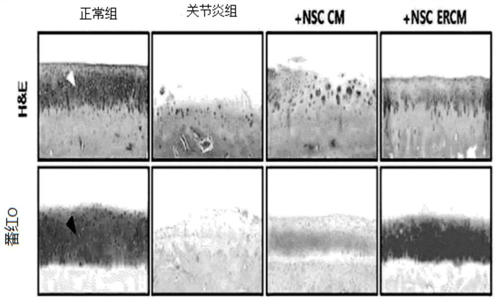 Composition comprising stem cell-derived exosome containing culture as effective ingredient for preventing or treating arthritis