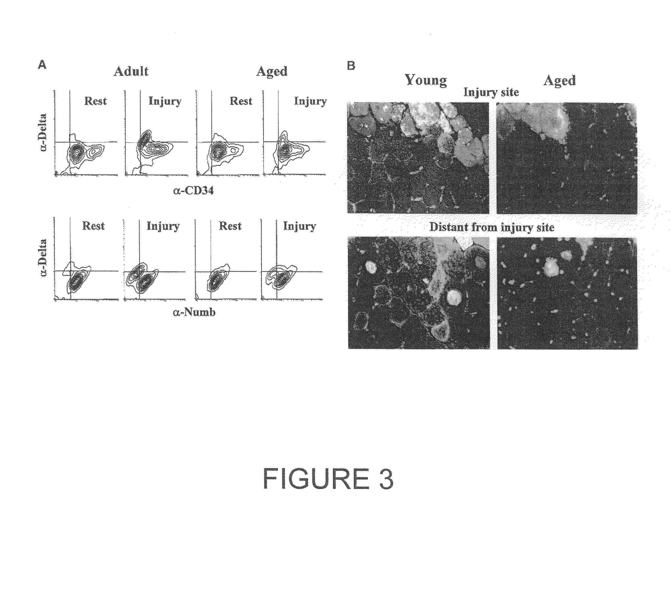 Methods and compositions for regeneration of aged skeletal muscle tissues