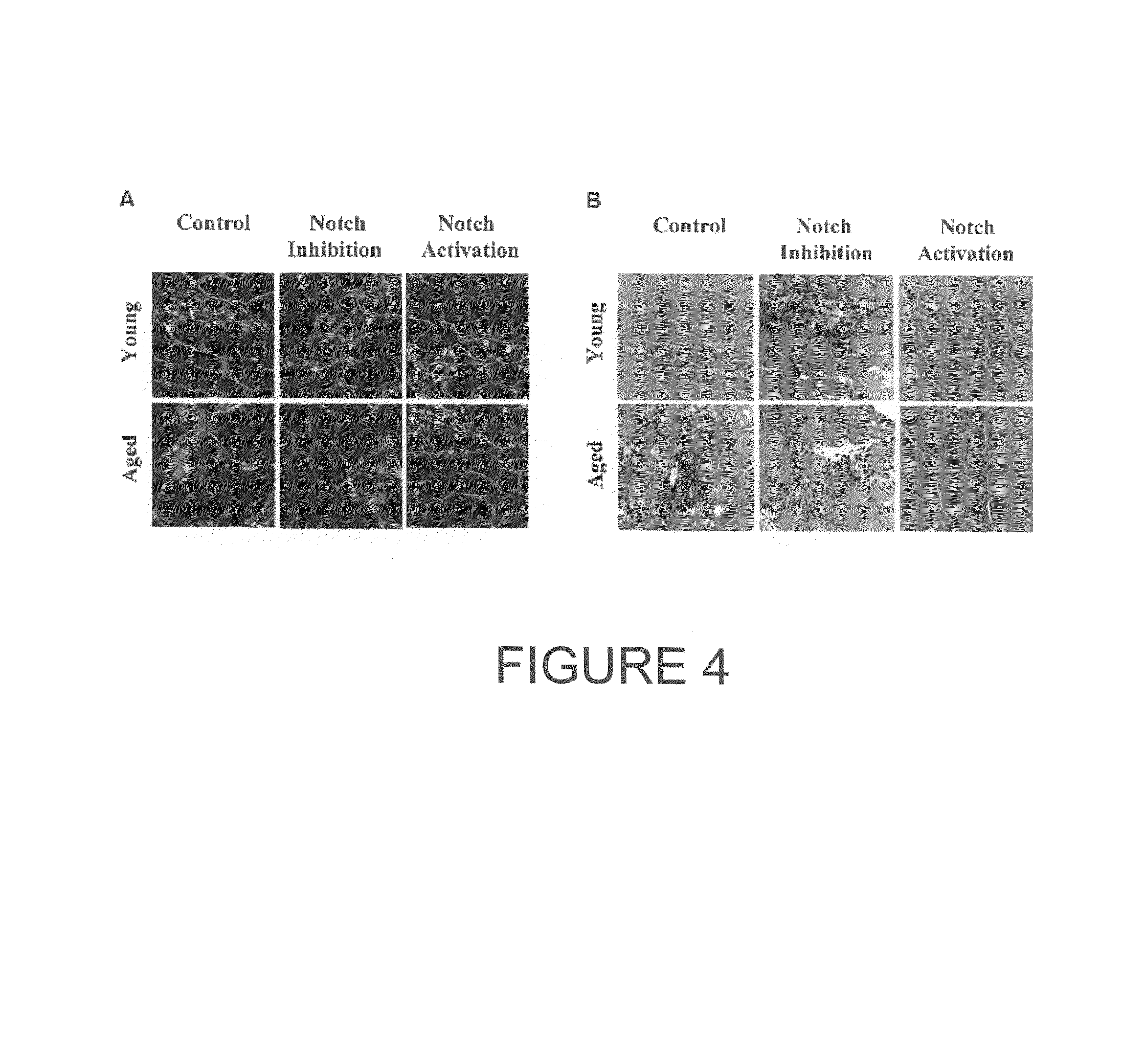 Methods and compositions for regeneration of aged skeletal muscle tissues