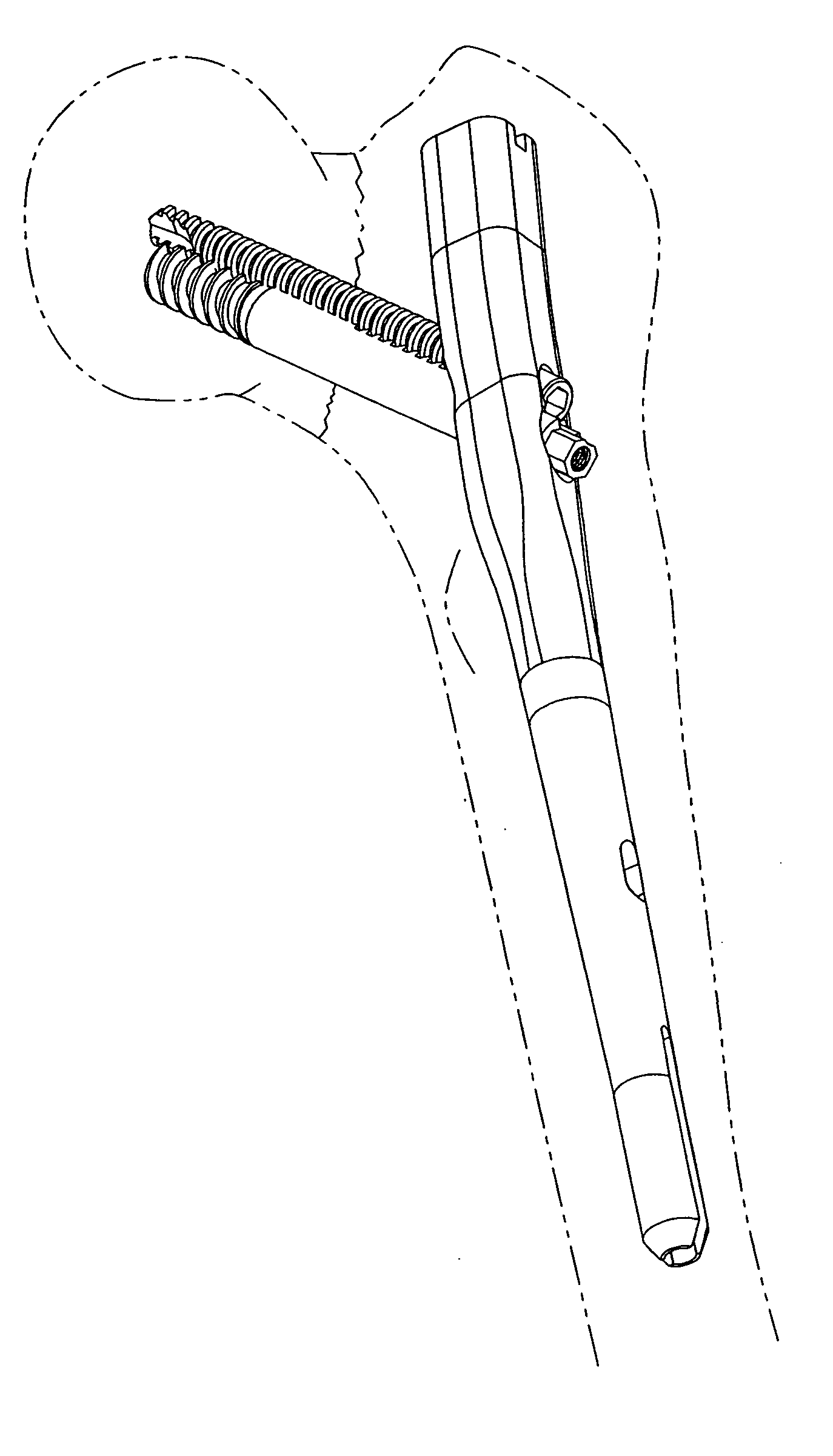 Orthopaedic plate and screw assembly