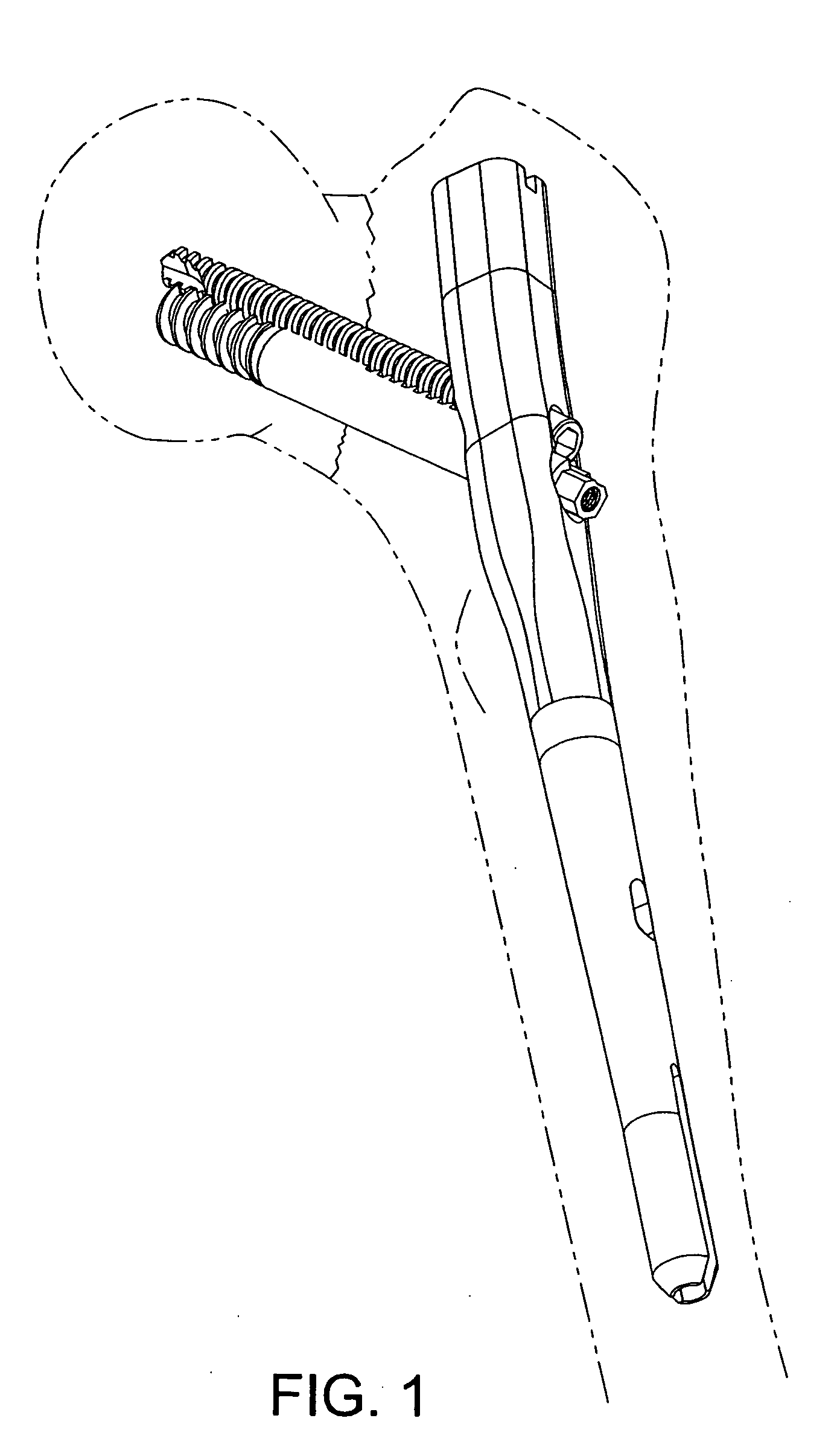 Orthopaedic plate and screw assembly