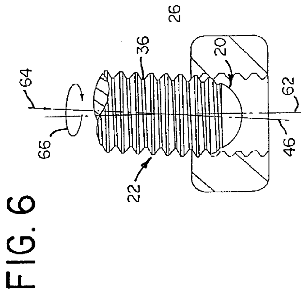 Short point anti-cross-threading design