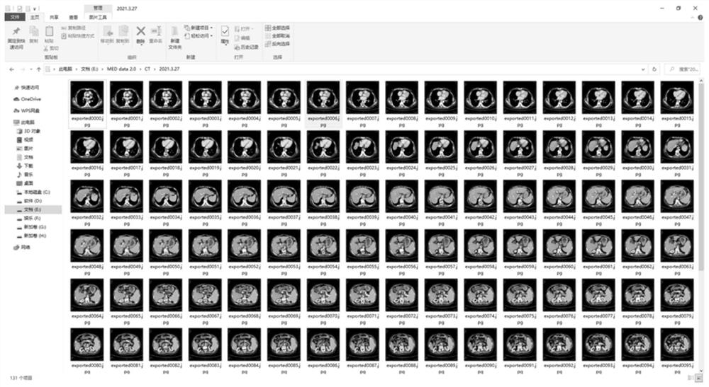 Virtual hepatic vein pressure gradient measurement method