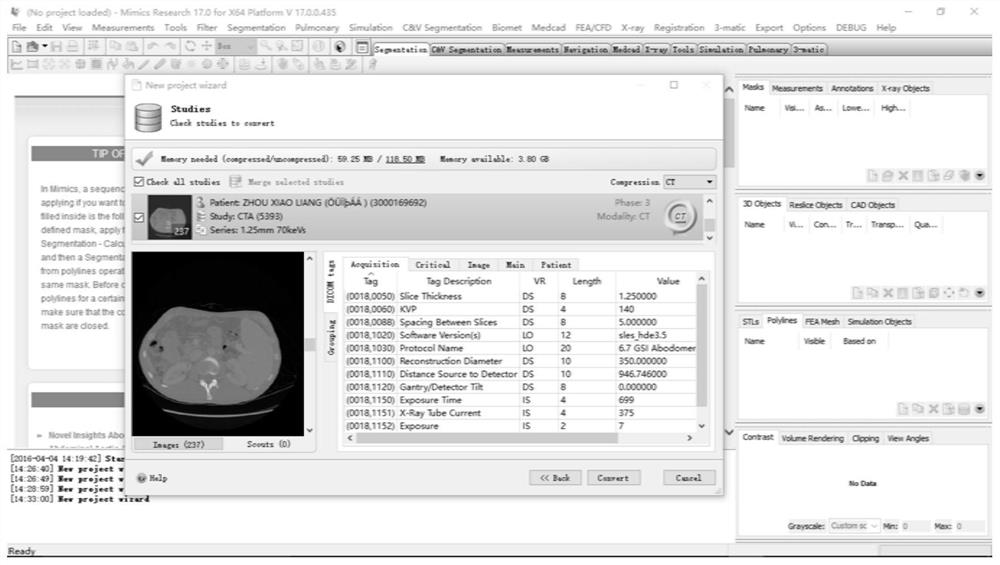 Virtual hepatic vein pressure gradient measurement method