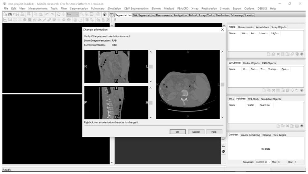 Virtual hepatic vein pressure gradient measurement method