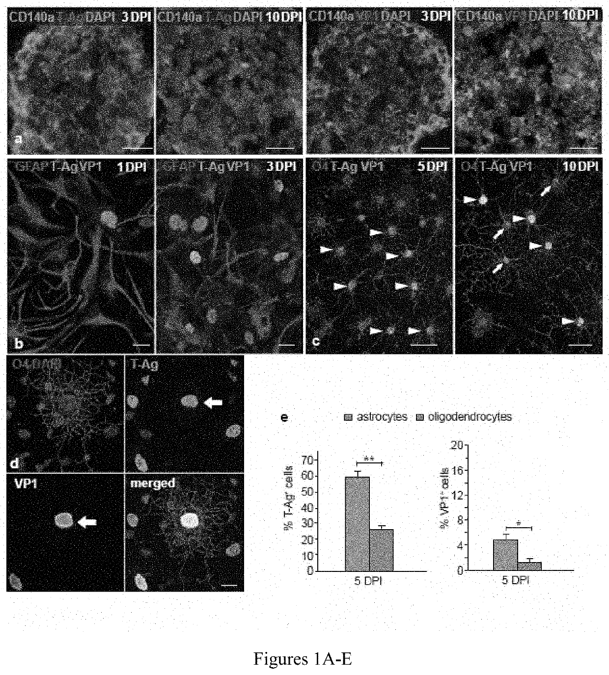 Human glial chimeric model for drug candidate assessment in human gliotrophic viral infections and progressive multifocal encephalopathy