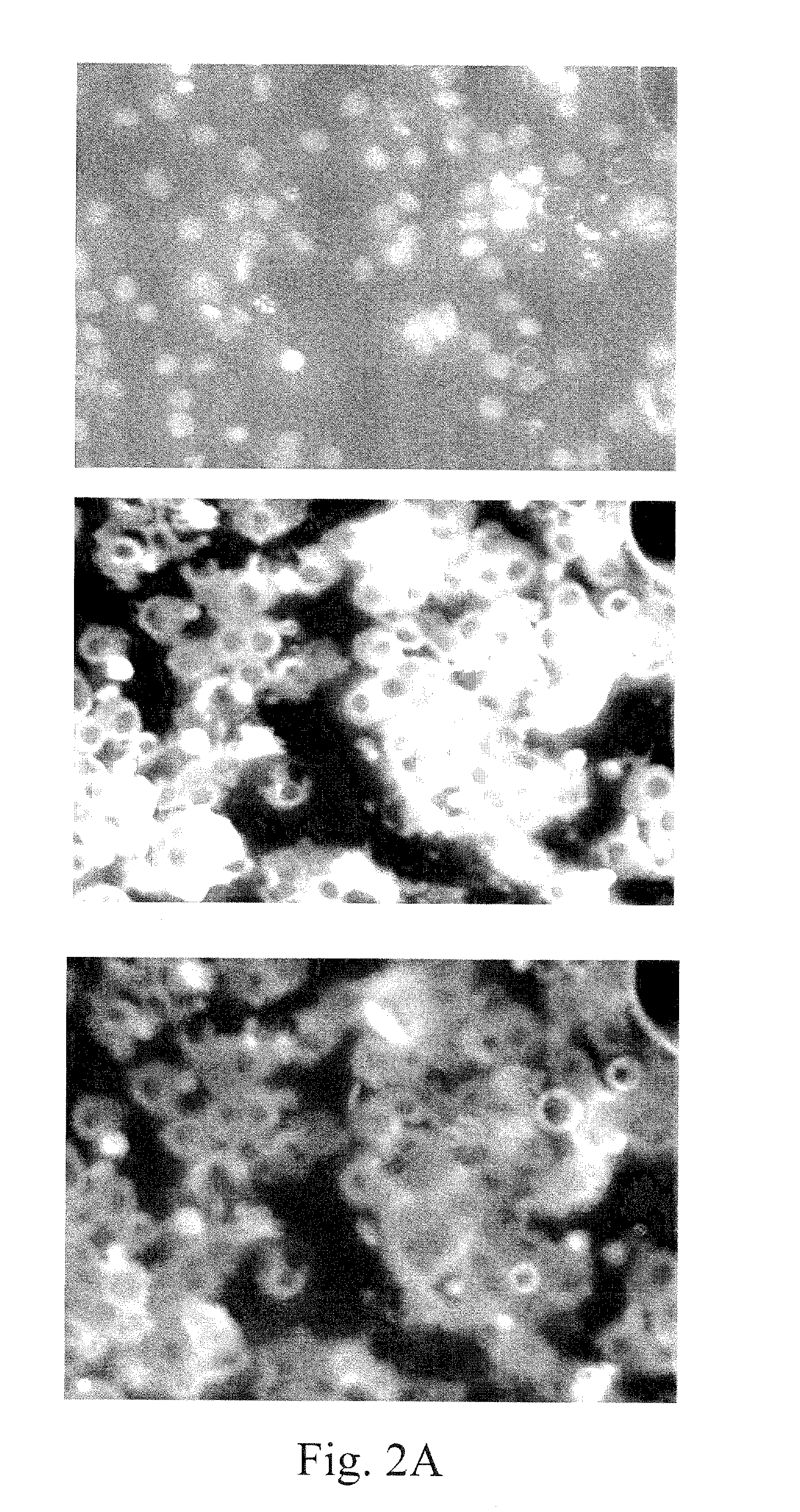 Human mast cell line and uses thereof