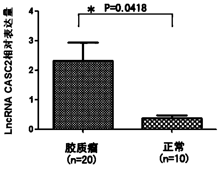 Application method of long non-coding RNA (ribonucleic acid) CASC2 originated from serum exosomes