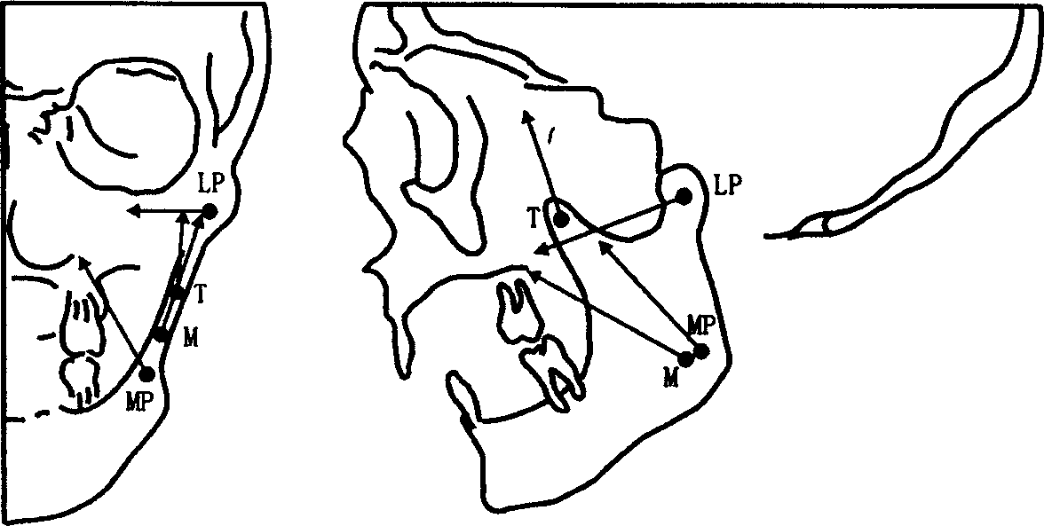 Biomechanical model of human lower jawbone