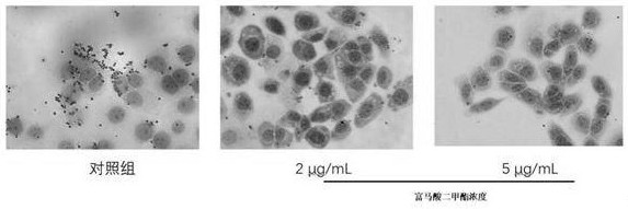 Dimethyl fumarate eye drops, preparation method thereof and application of dimethyl fumarate eye drops as medicine for treating fungal keratitis