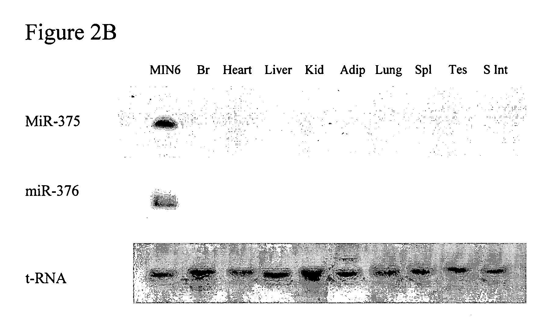 Pancreatic islet microRNA and methods for inhibiting same