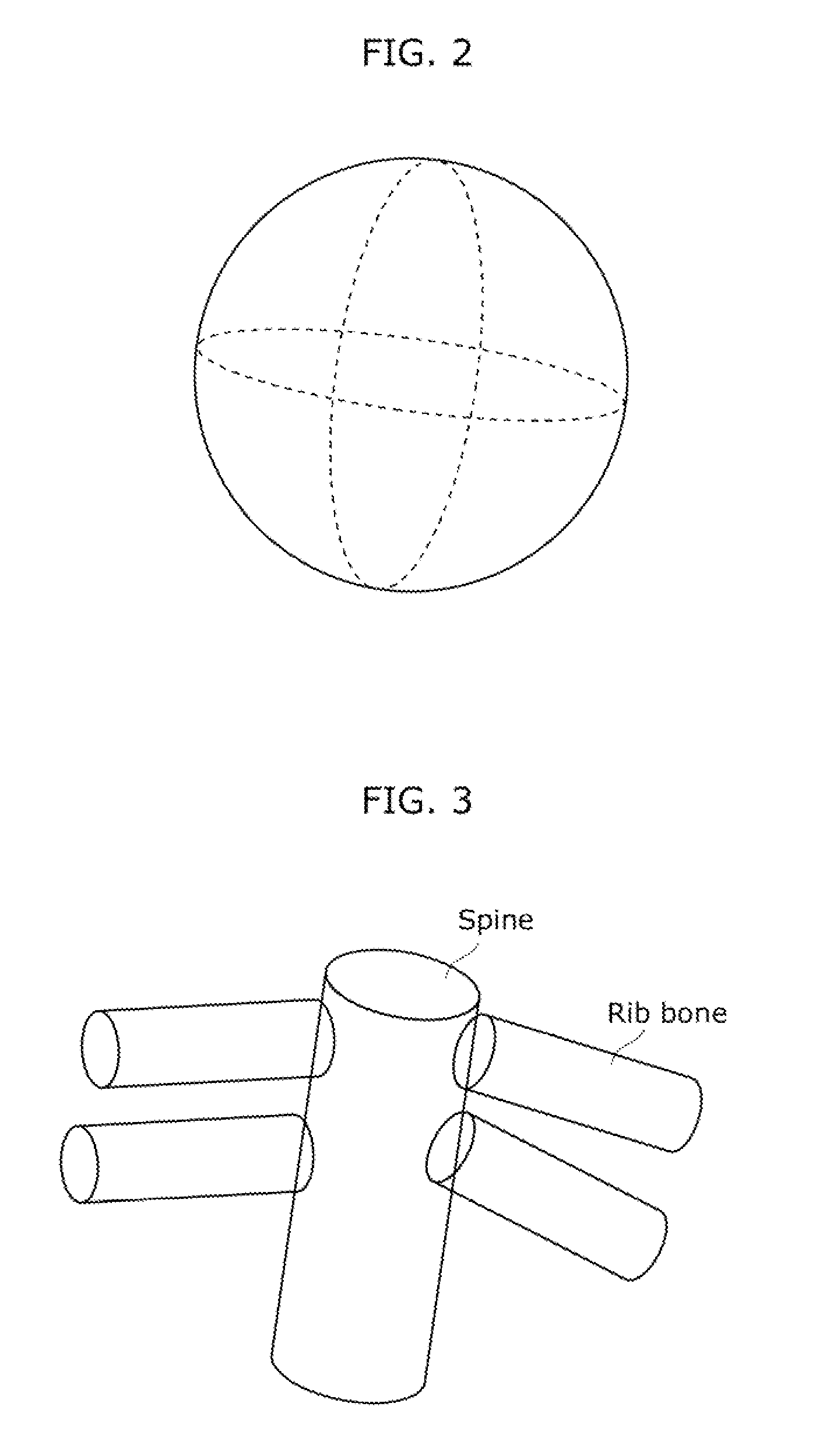 Ultrasound diagnostic apparatus