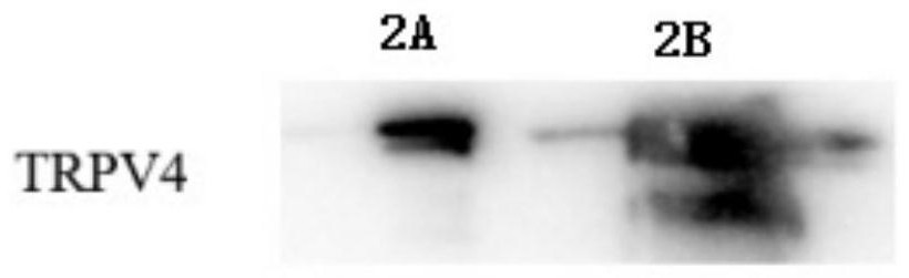 Recombinant TRPV4 protein and preparation method thereof