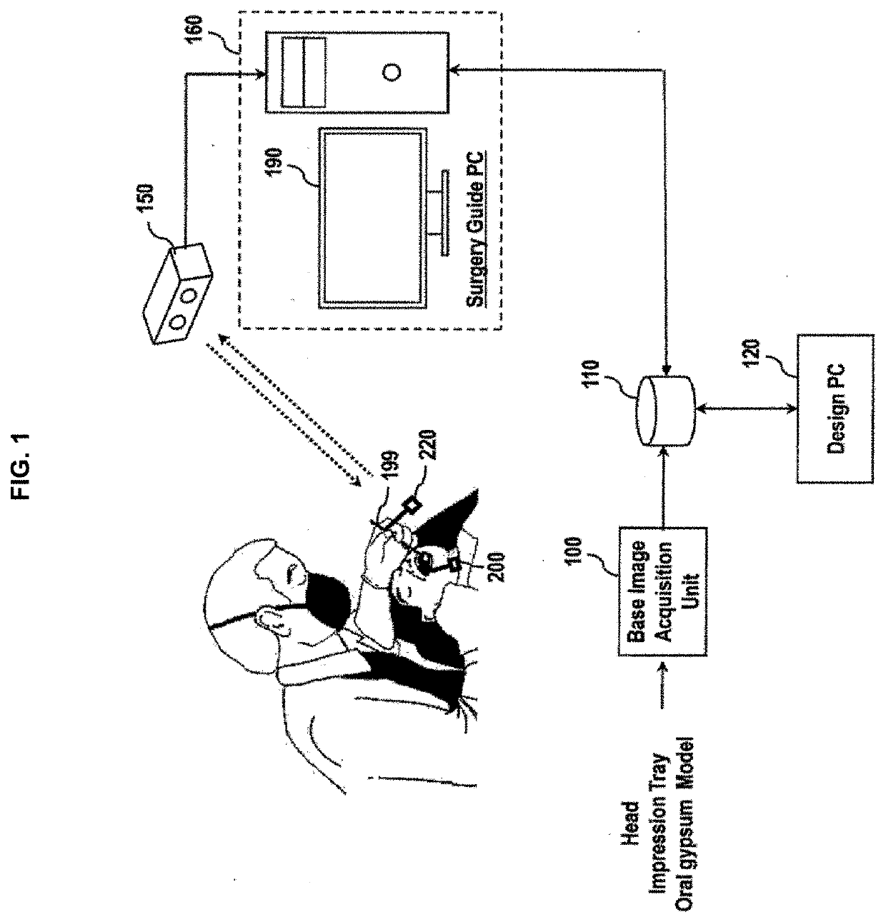 Implant surgery guiding method