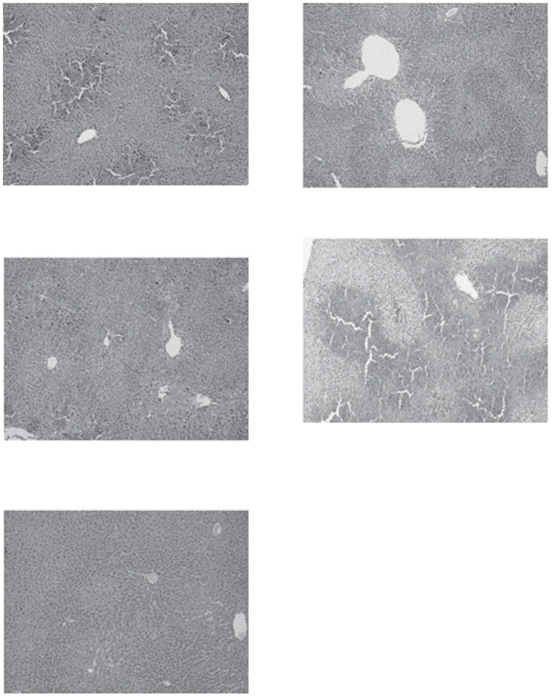 Preparation method of UCMSC (umbilical cord mesenchymal stem cell) modified with HGF (hepatocyte growth factor) gene and used for treating liver failure