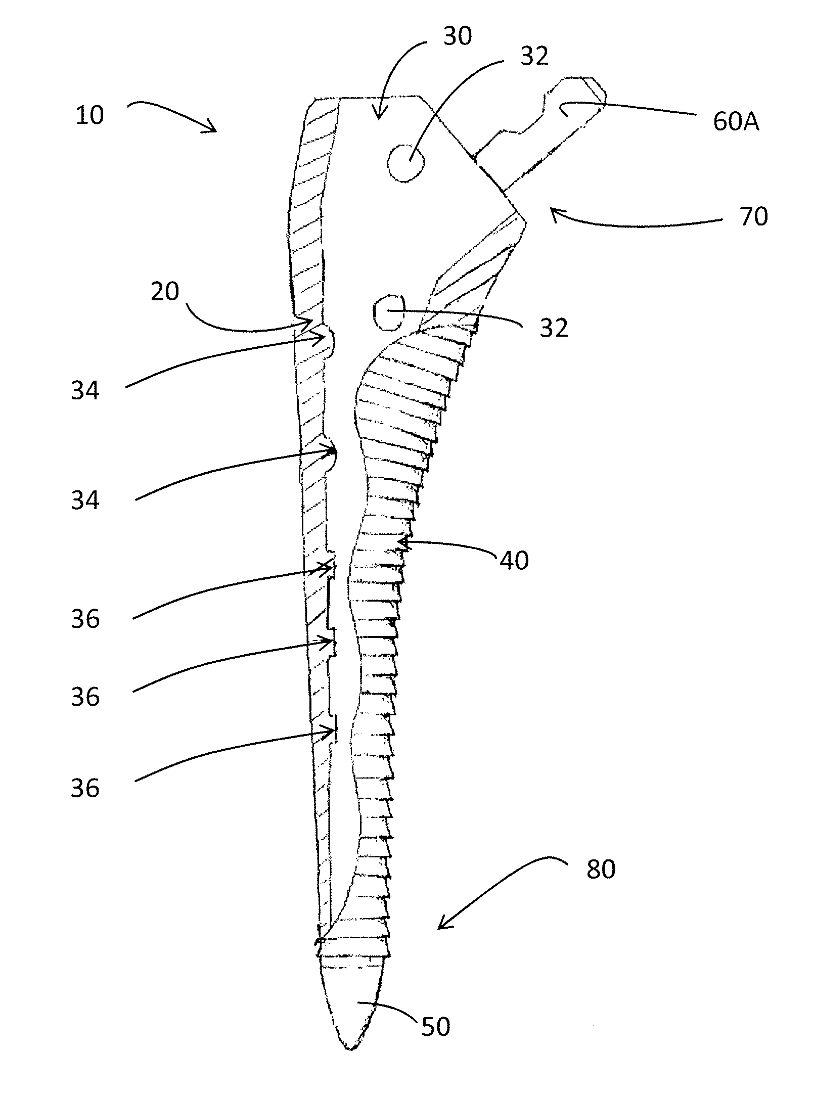 Device for use in orthopaedic surgery