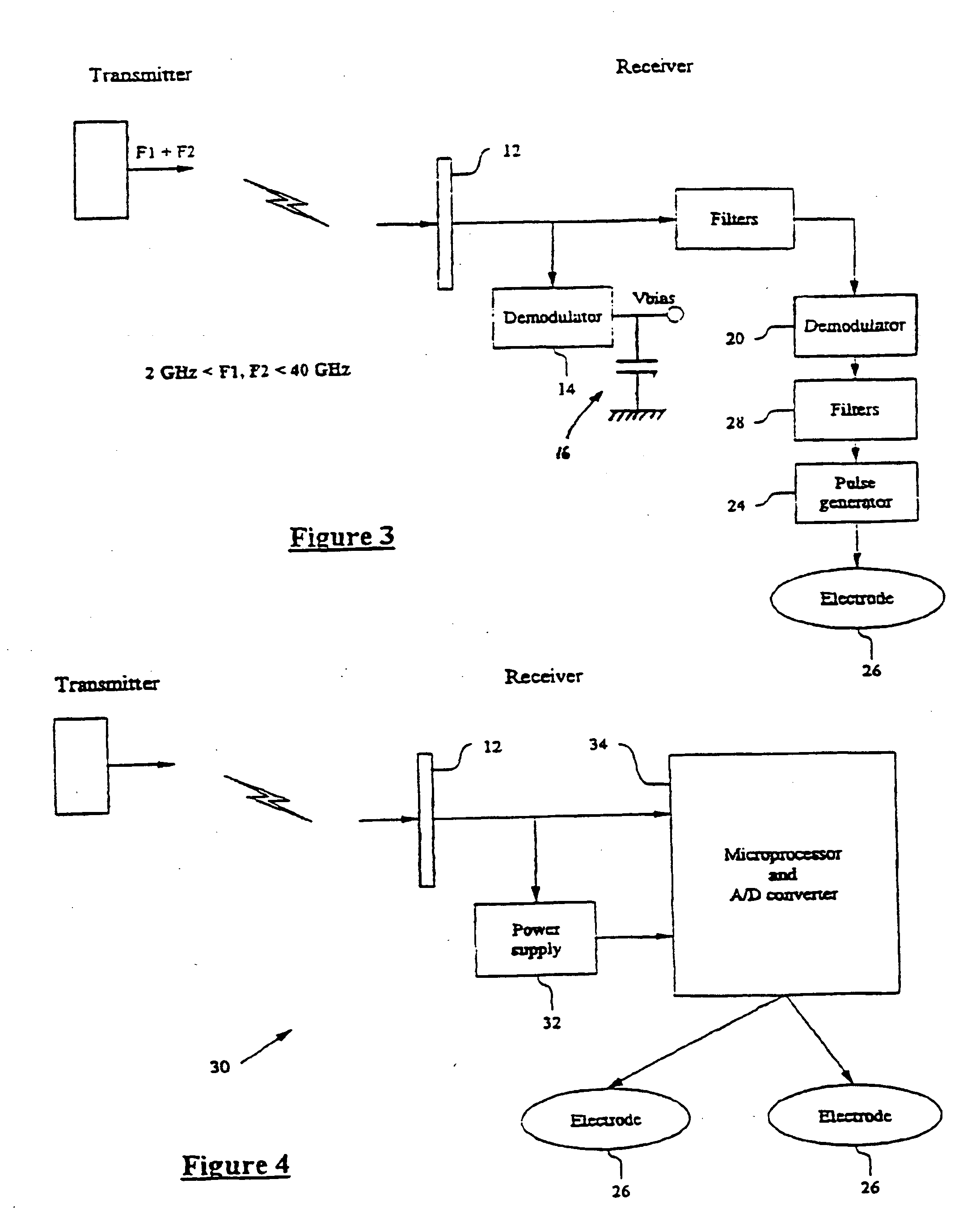 Medical implant system