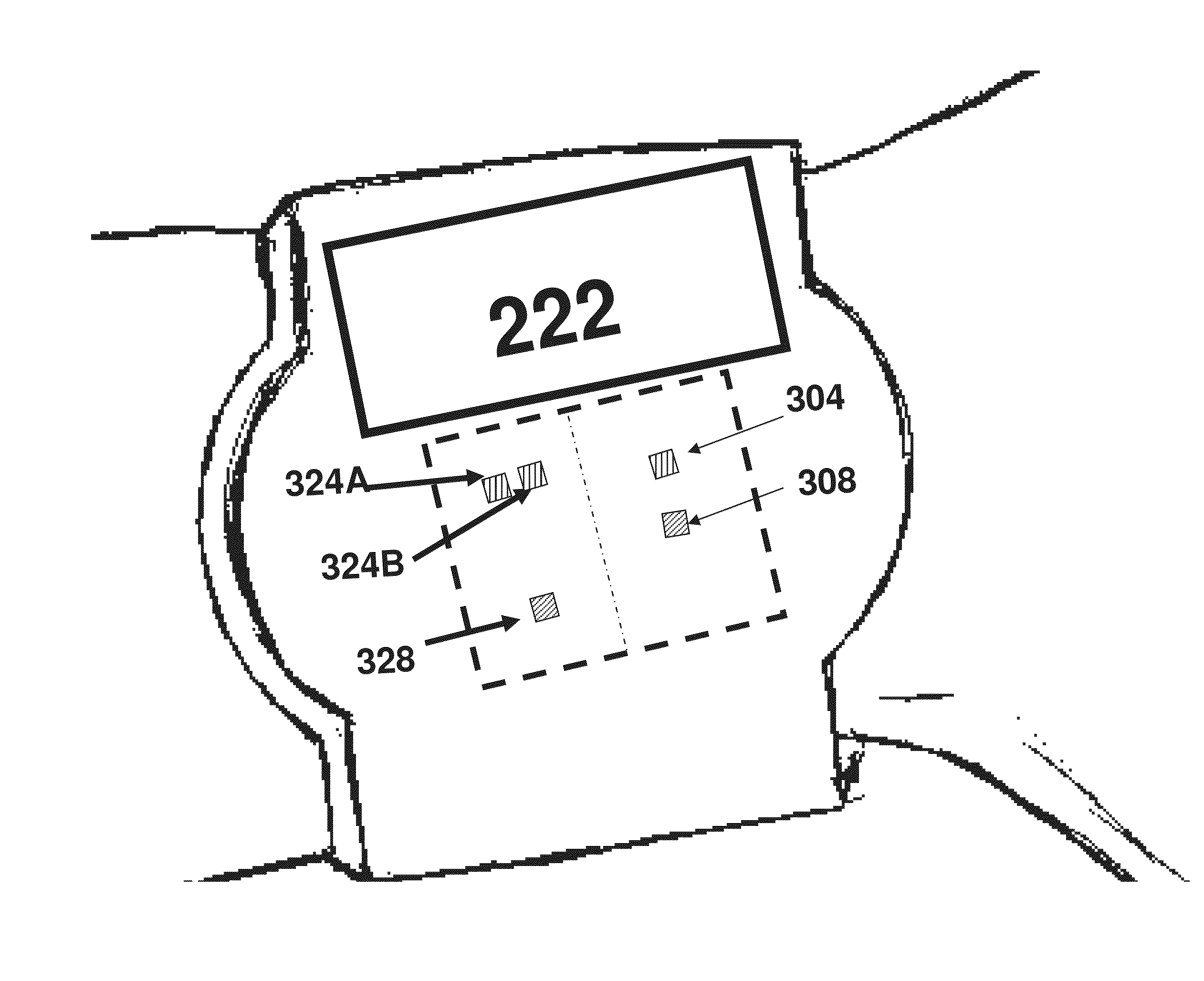 Photoplethysmography device and method