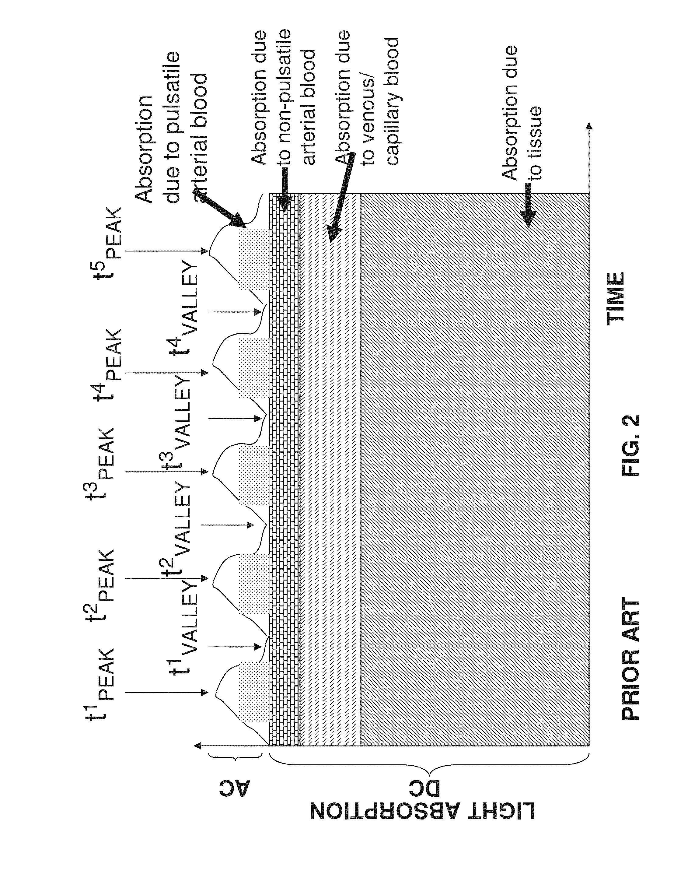 Photoplethysmography device and method