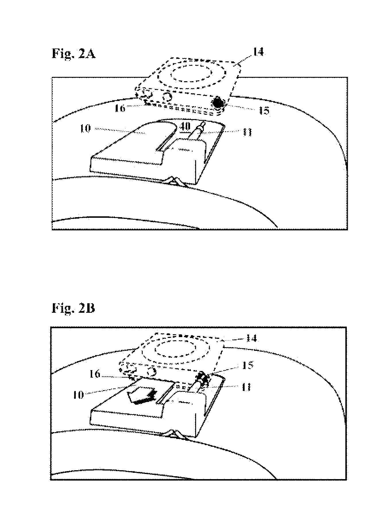 Apparatus for Mounting an Audio Player