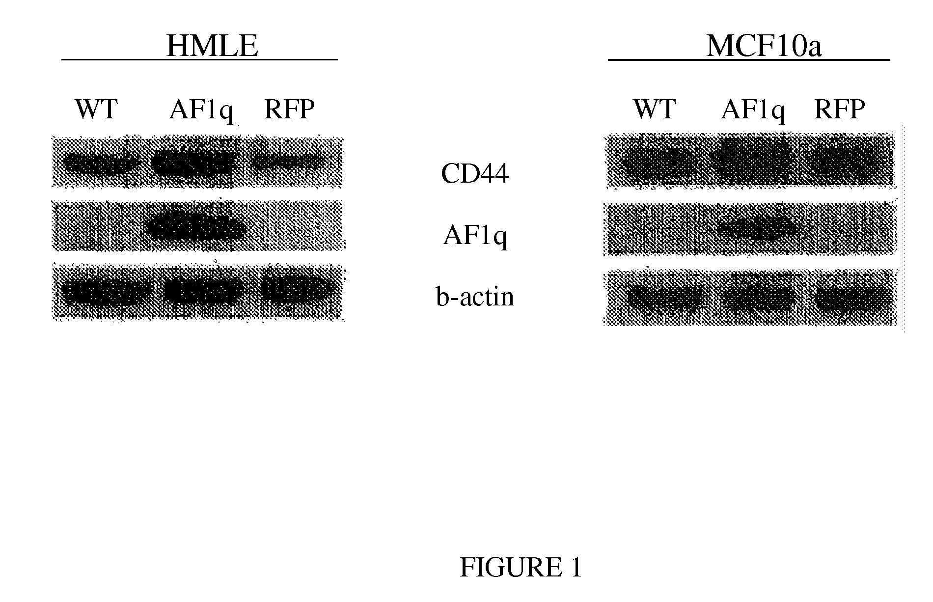 Method for Enhancing Umbilical Cord Blood Engraftment