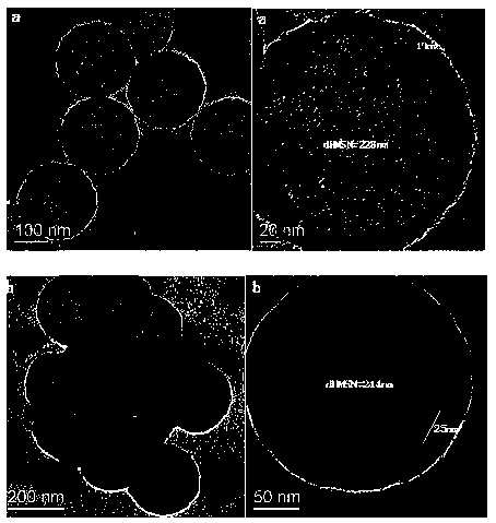 Composite nano-microsphere having drug controlled release performance, and preparation method and application thereof