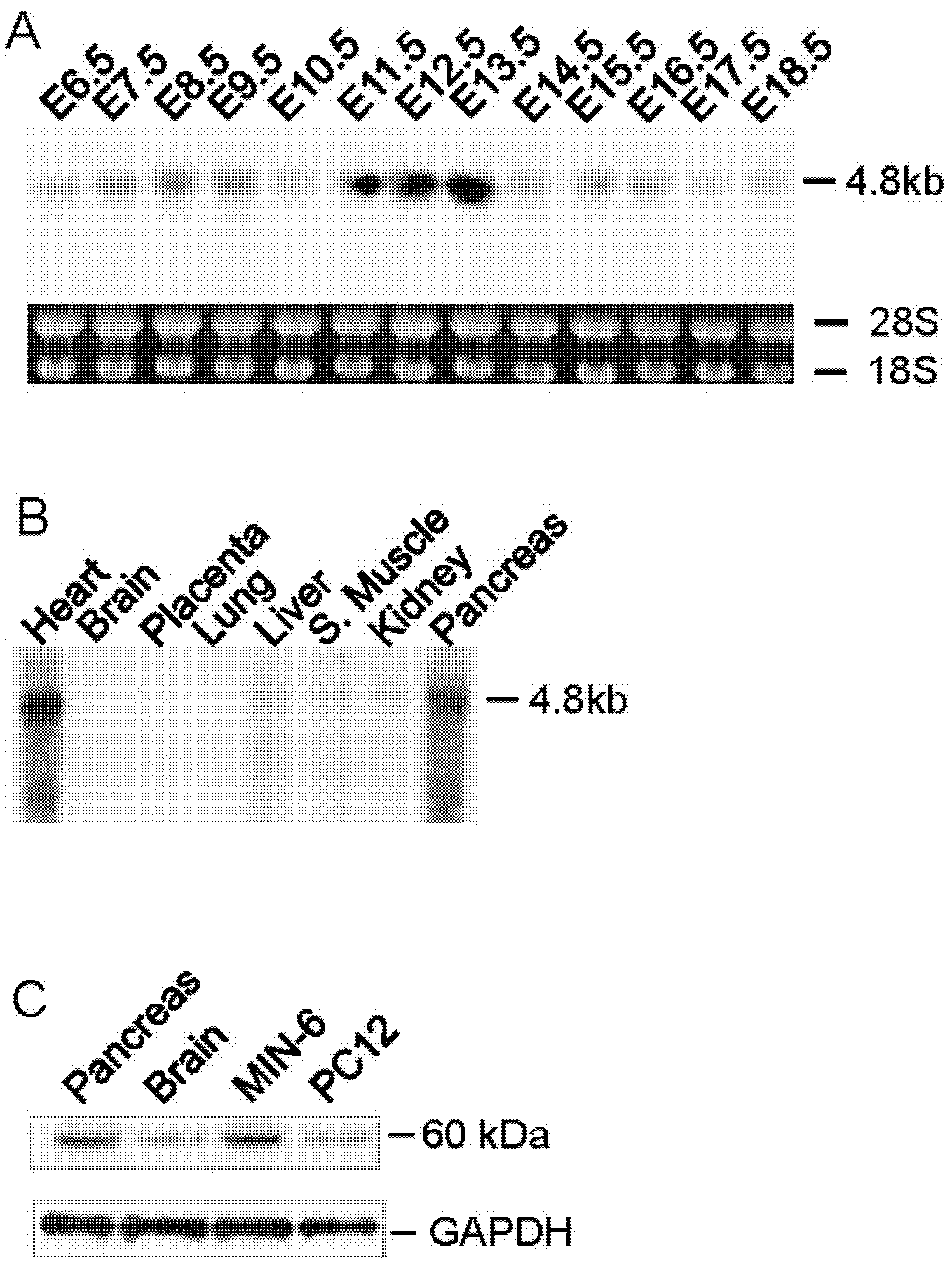 Method for purifying and recognizing pancreatic endocrine cells