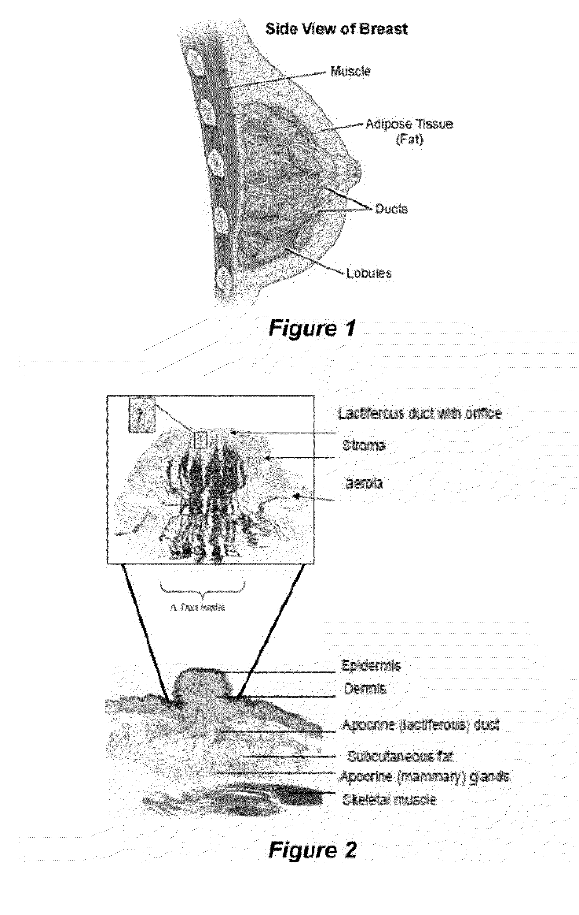 Compositions and Methods for Localized Drug Delivery through Mammary Papillae