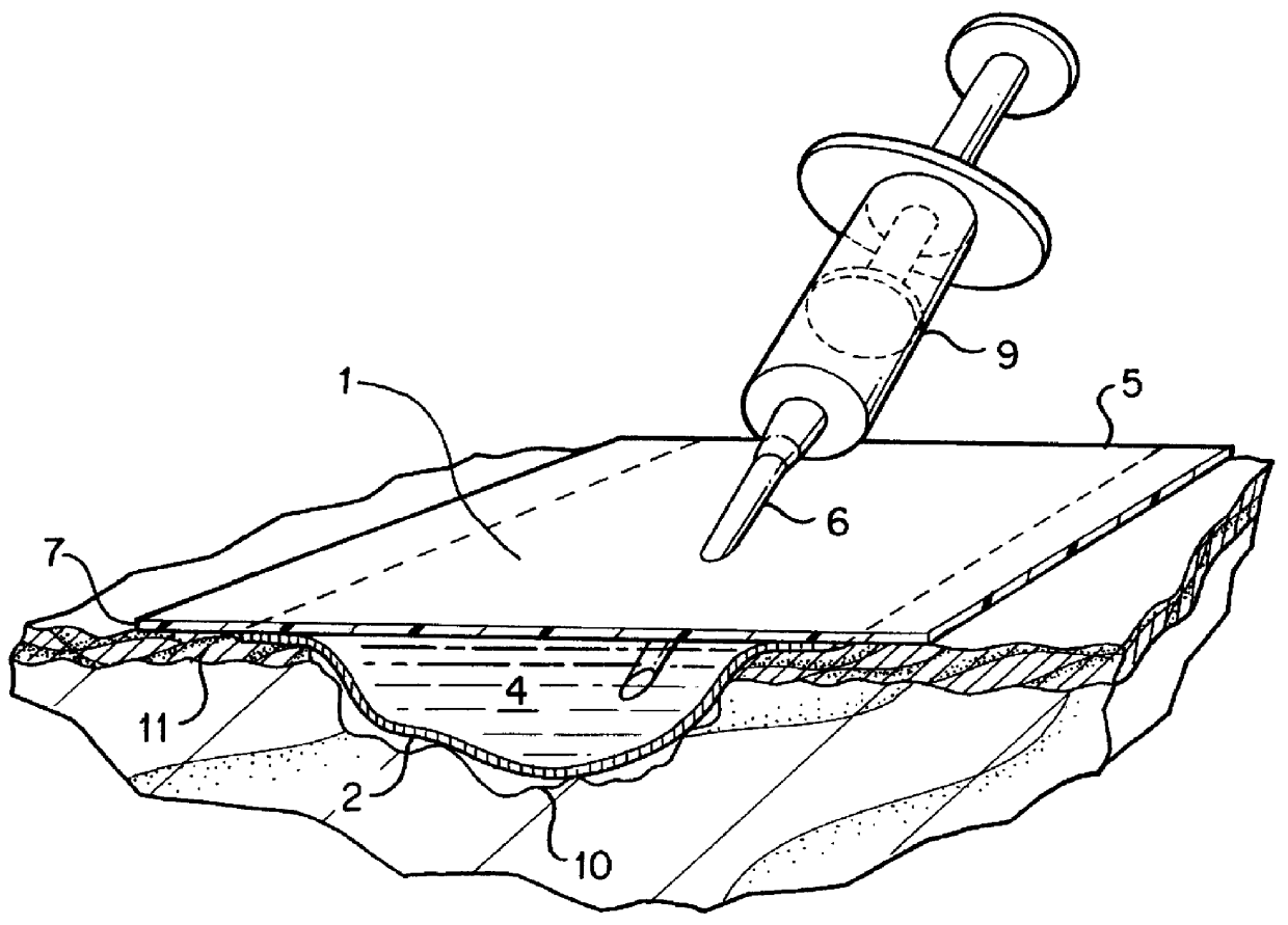 Bioreactor wound dressing