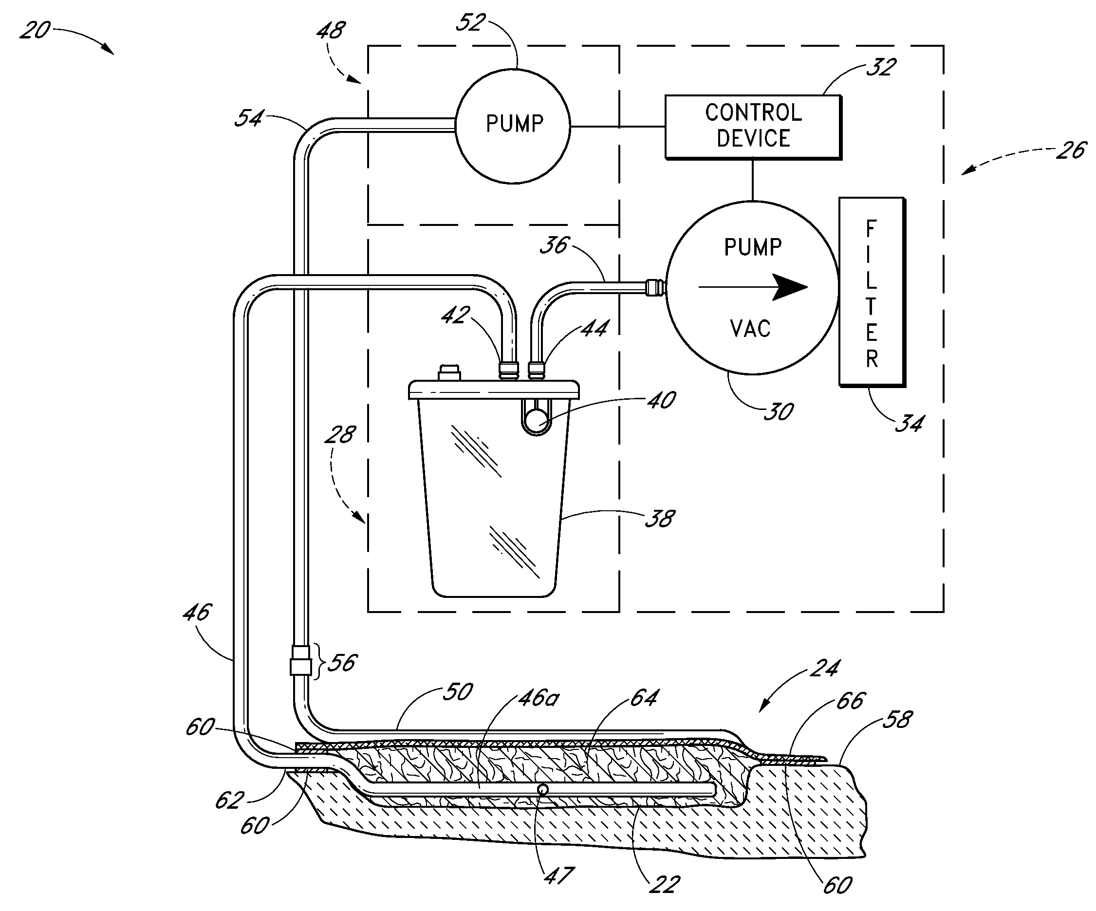 Negative Pressure Dressing and Method of Using Same